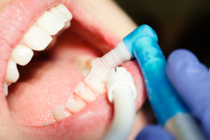 Close-up of a person's mouth