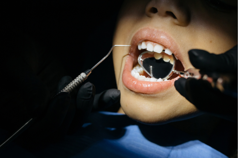 Teeth Grinding or Clenching in Children