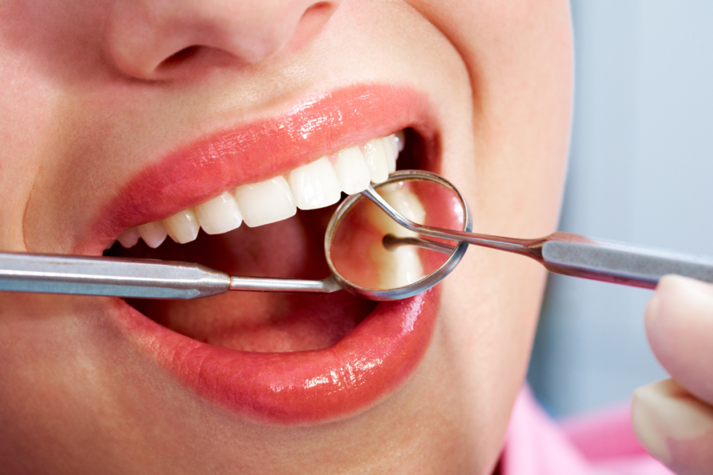 Dental fillings naples dental boutique 1