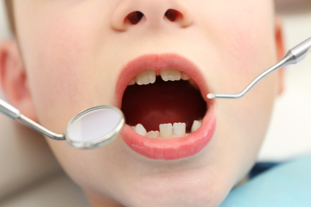 Pediatric dental emergencies naples dental boutique 2