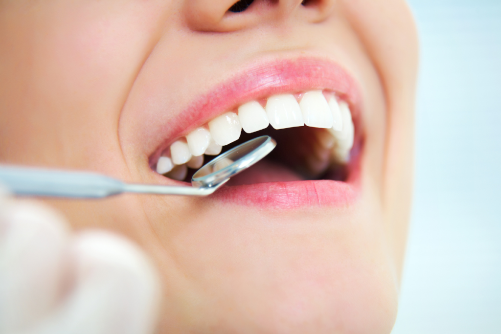Same day crowns naples dental boutique 2