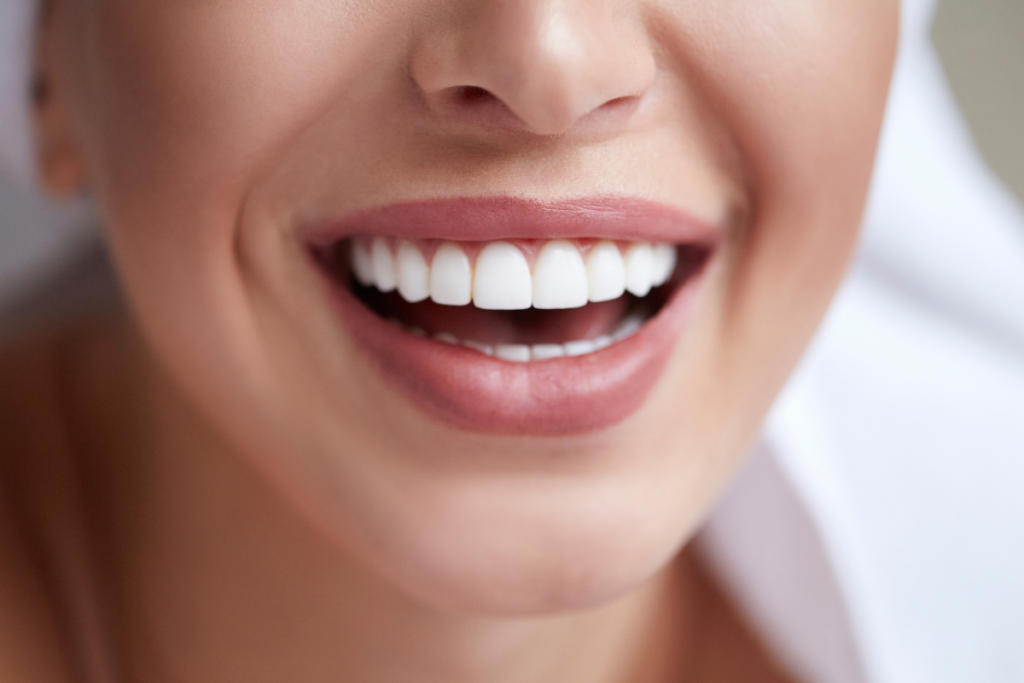 Teeth whitening naples dental boutique 1