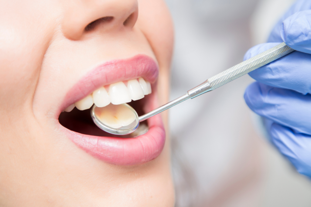 Tooth extractions naples dental boutique 2