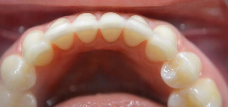 6 after