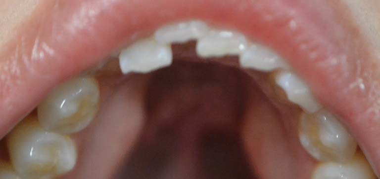9 before
