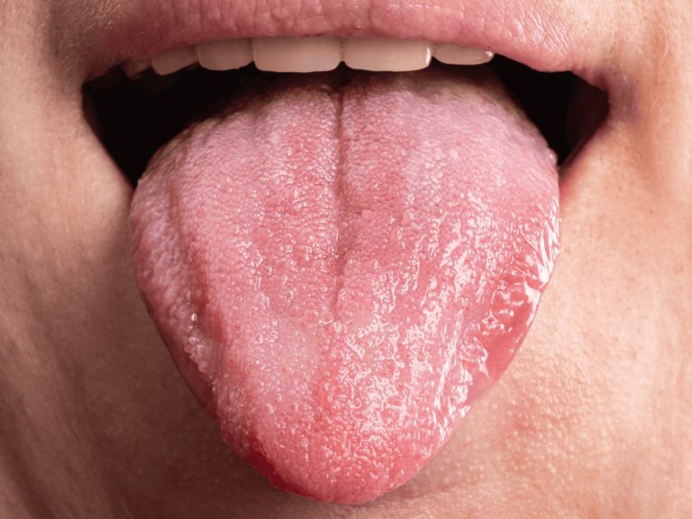 Oral cancer screenings 11