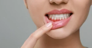 Gum disease