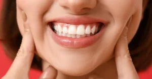Smile